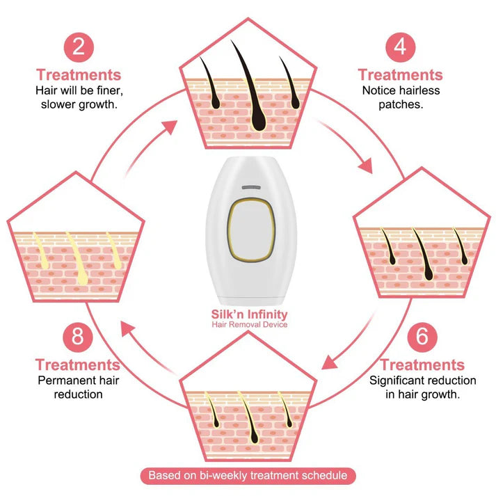 IPL Hair removal